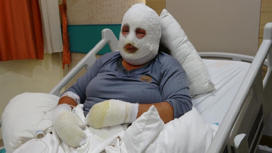 Ardahan'da Ağılda Yangın: Anne ve Kızının Kahramanca Kurtarma Çabası