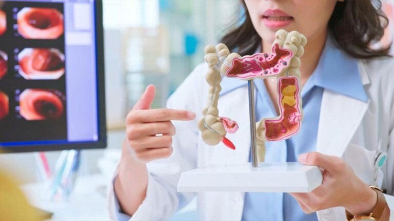 Casso bağırsak görevi nedir? Akıllı bağırsak fonksiyonları ve özellikleri nelerdir?